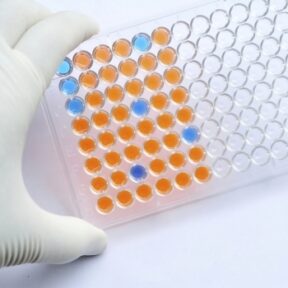 Unacylated Ghrelin (human) EIA kit